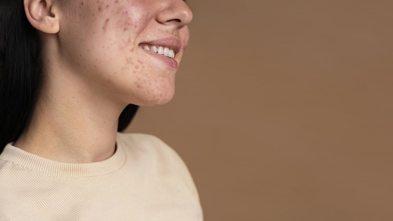 Podrażniona, swędząca skóra twarzy — o czym świadczy?